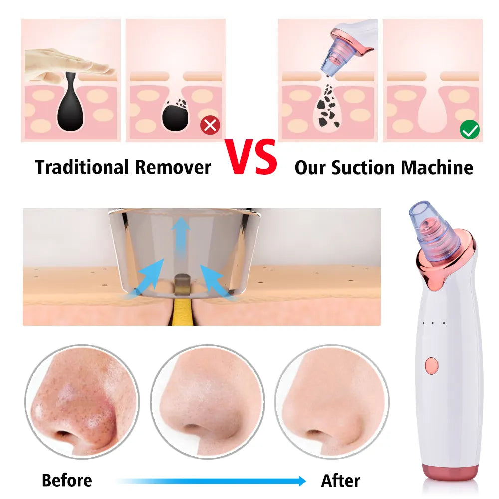 Facial Blackhead Remover Electric Facial Care Devices